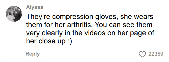 Another user explains Dolly Parton wears skin-colored compression gloves for arthritis, not just to hide tattooed hands. Another user explains Dolly Parton wears skin-colored compression gloves for arthritis, not just to hide tattooed hands.
