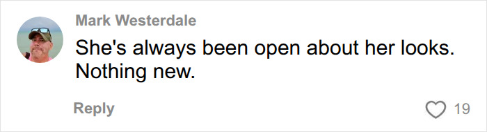 Mark Westerdale's comment on Dolly Parton's tattooed hands and skin-colored gloves, noting her openness about looks. Mark Westerdale's comment on Dolly Parton's tattooed hands and skin-colored gloves, noting her openness about looks.