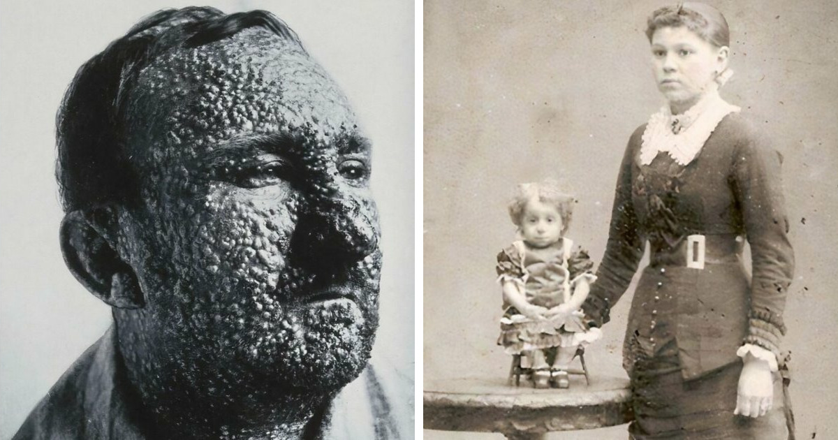 Fascinating Posts About The Victorian Era That Show How Different Life Was