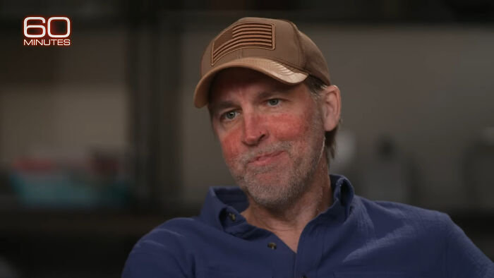 Man with a beard and a cap, appearing pensive, likely discussing his experience with cancer med and its side effects. Man with a beard and a cap, appearing pensive, likely discussing his experience with cancer med and its side effects.