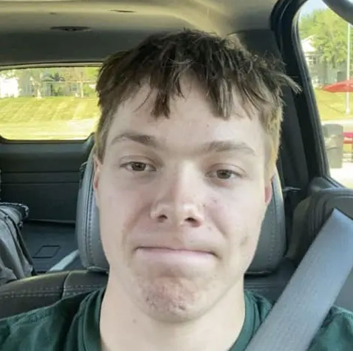 A young man with a messy, uneven haircut, looking directly at the camera with a neutral expression, showing bold hairstyles.