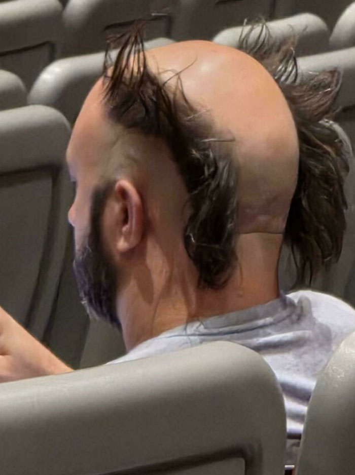 A man with a bald head and scraggly hair around the sides, representing bold hairstyles.