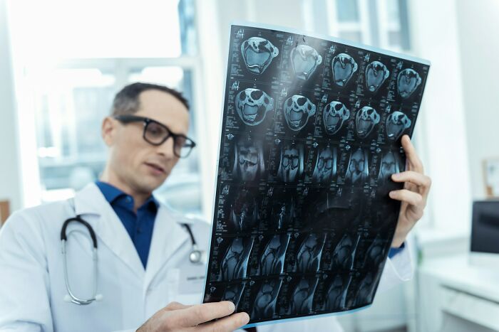 A medical field worker in glasses and a stethoscope examines an X-ray. Medical field workers are dedicated to diagnosis and care.