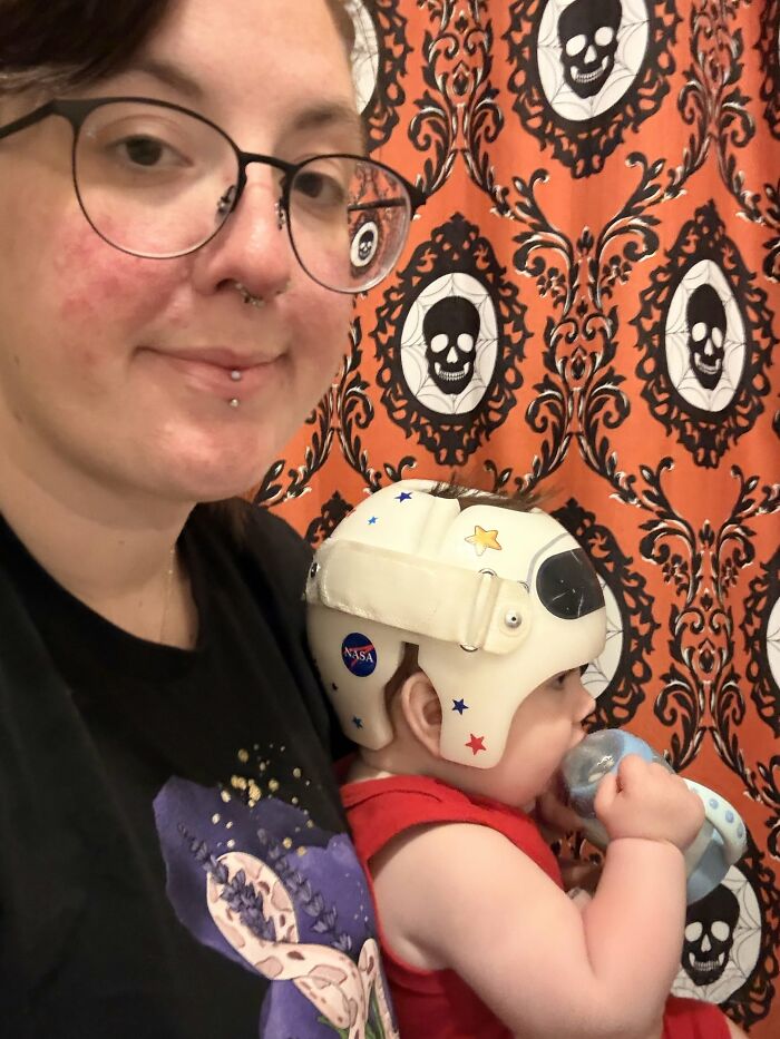 A mom holding a baby in a helmet, portraying the challenges yet rewarding journey of motherhood.