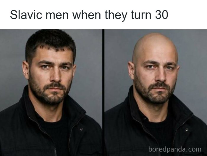 A meme comparing a man with hair to the same man bald, captioned Slavic men when they turn 30, illustrating Eastern Europe memes.