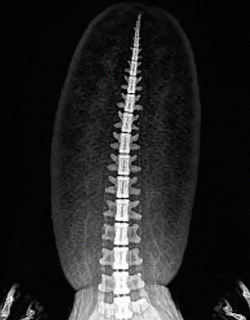 An X-ray of a spine inside an elongated, strange body, an incredible thing happening on Earth.