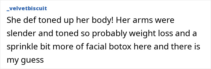 Joey King faces plastic surgery accusations after flashing underwear at movie premiere. Comment on weight loss and facial botox. Joey King faces plastic surgery accusations after flashing underwear at movie premiere. Comment on weight loss and facial botox.