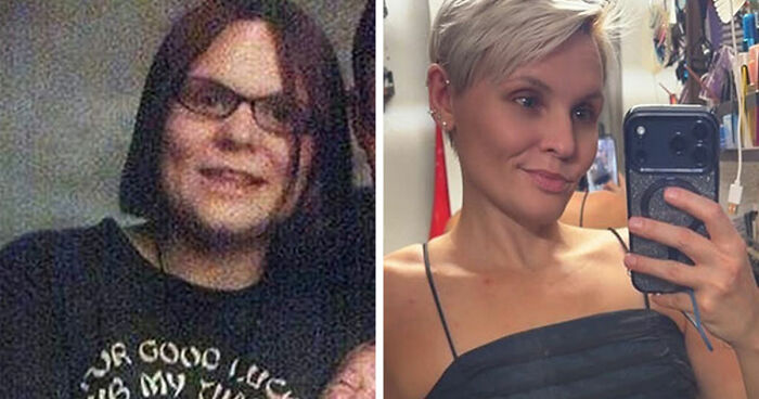 69 Side-By-Side Photos That Show That People Changed For The Better Over Time
