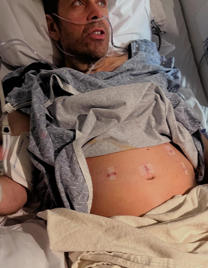 Perez Hilton in a hospital bed, showing his bare abdomen with several bandaged surgical wounds, after suffering significant injuries. Perez Hilton in a hospital bed, showing his bare abdomen with several bandaged surgical wounds, after suffering significant injuries.