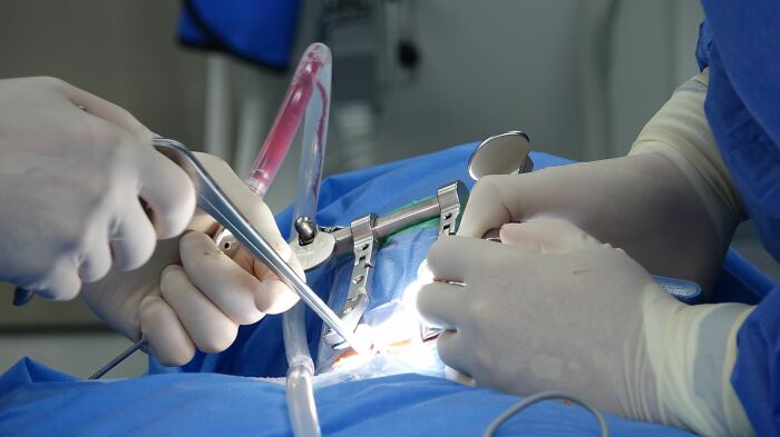 62 Patients Share The Medical Procedures That Hurt Far More Than Doctors Had Led Them To Expect