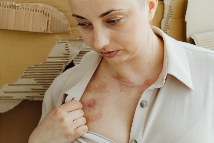 62 Patients Share The Medical Procedures That Hurt Far More Than Doctors Had Led Them To Expect