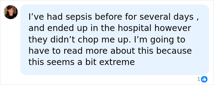 A social media comment from someone who had sepsis, questioning the extreme measure of limb amputation. A social media comment from someone who had sepsis, questioning the extreme measure of limb amputation.