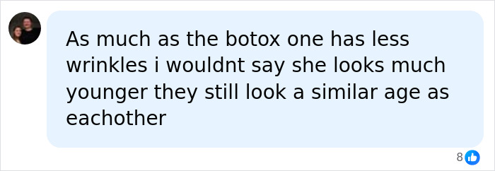 A social media comment discussing identical twins and the dramatic differences in wrinkles after Botox use. A social media comment discussing identical twins and the dramatic differences in wrinkles after Botox use.
