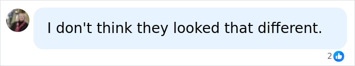 A comment about the dramatic differences between identical twins, one using Botox, stating they didn't look different. A comment about the dramatic differences between identical twins, one using Botox, stating they didn't look different.
