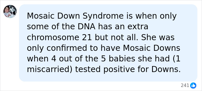 A social media post explaining Mosaic Down Syndrome, where only some DNA has an extra chromosome 21. Mother of four had diagnosis. A social media post explaining Mosaic Down Syndrome, where only some DNA has an extra chromosome 21. Mother of four had diagnosis.