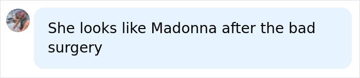 A comment about Noah Cyrus desert photoshoot, comparing her look to Madonna after bad surgery. A comment about Noah Cyrus desert photoshoot, comparing her look to Madonna after bad surgery.