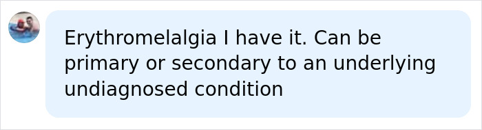 A social media comment mentioning Erythromelalgia in relation to the teen's mysterious condition after 5 years in a pond.