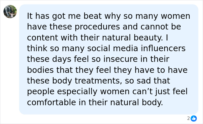 How Young Is Too Young To Get A Korean Facelift? Netizens Criticize Influencer's Decision After Recovery Posts How Young Is Too Young To Get A Korean Facelift? Netizens Criticize Influencer's Decision After Recovery Posts