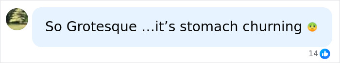 A reaction comment: So Grotesque ...it's stomach churning 🤢, about the surgeon's horrific crimes and amputation.