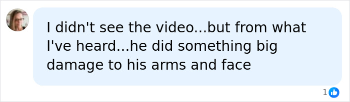 A social media comment speculating about Perez Hilton's disfigurement: He did something big damage to his arms and face. A social media comment speculating about Perez Hilton's disfigurement: He did something big damage to his arms and face.