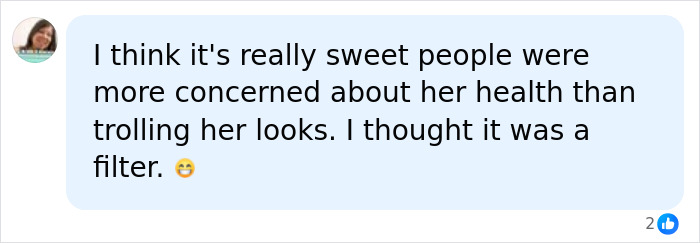Woman Flooded With Messages Urging Her To Seek Help After Noticing Unique Detail Of Daughter's Appearance Woman Flooded With Messages Urging Her To Seek Help After Noticing Unique Detail Of Daughter's Appearance