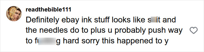 A comment about poor quality ebay ink and needles for face tattooing leading to scarring. A comment about poor quality ebay ink and needles for face tattooing leading to scarring.