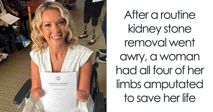 Woman Woke Up Without Her Limbs After Routine Surgery And Told Doctors She Was Fine With It