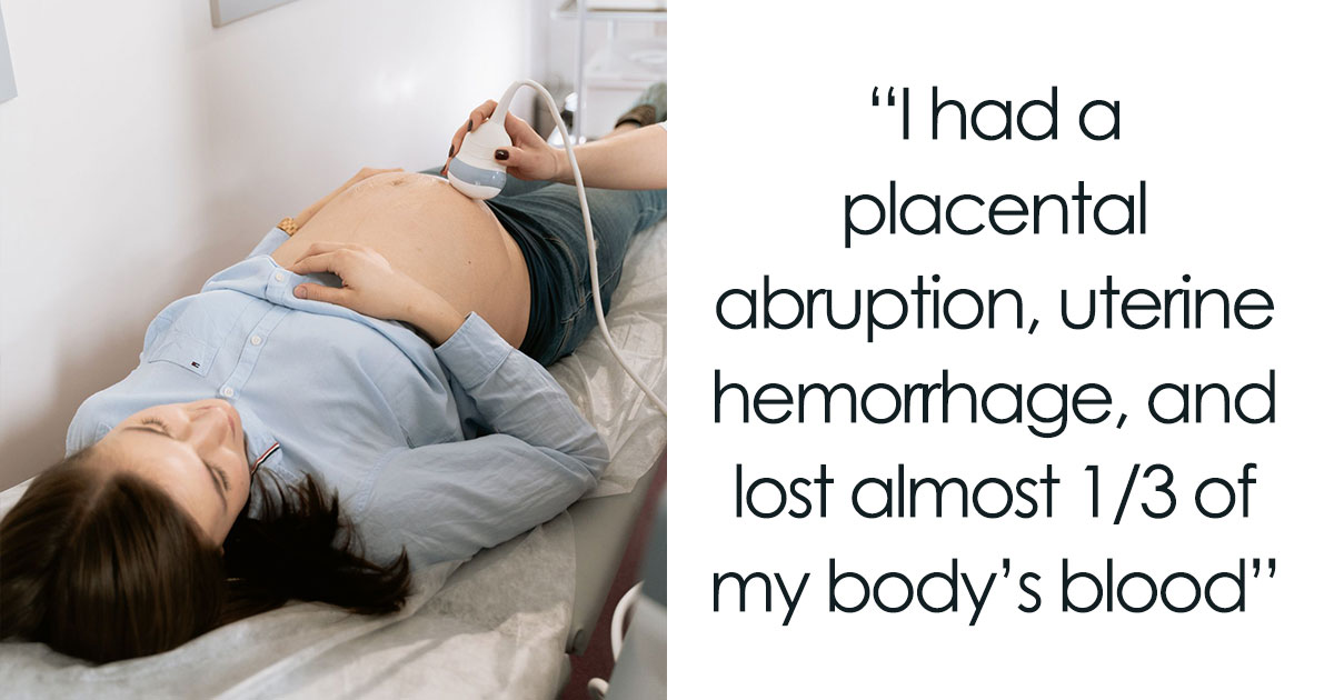 54 Horrible Things Pregnant Women Went Through That They Never Expected