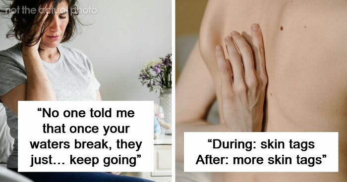 54 Moms Open Up About The Brutal Things Their Bodies Endured To Give Birth