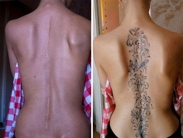 Before and after image of a tattoo cover-up transforming a back scar into an elegant floral spine tattoo.