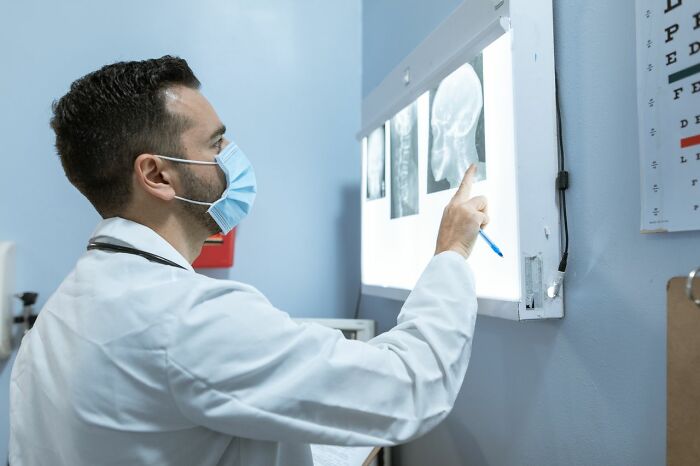 Medical professional examining an X-ray, demonstrating the complexities of mental health disorders.