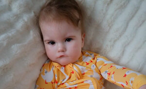 Mom Knew Something Was Wrong When Her Baby Couldn’t Form Expressions, Then Doctors Discovered A Rare Condition