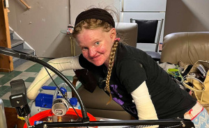 Woman With One Of The World’s Rarest Skin Conditions Details Extreme Measures To Protect Herself