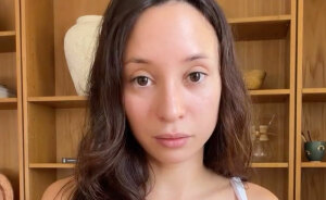 Influencer Reveals The Life-Long Consequences Of Getting Illegal Plastic Surgery: 