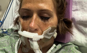 Woman Who Lost ‘A Lot Of My Leg’ To Flesh-Eating Bacteria Warns Women About Common Pre-Swim Habit