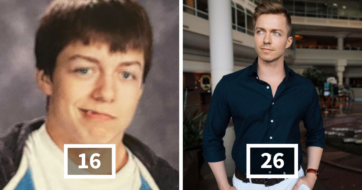 70 Ugly Ducklings Share Their Incredible Transformations (New Pics)