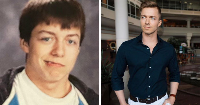 70 Ugly Ducklings Share Their Incredible Transformations (New Pics)