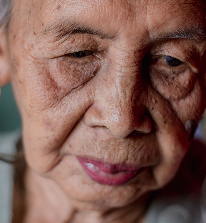 A close-up of an elderly female patient looking down, showing detailed wrinkles. Patients said weird things.