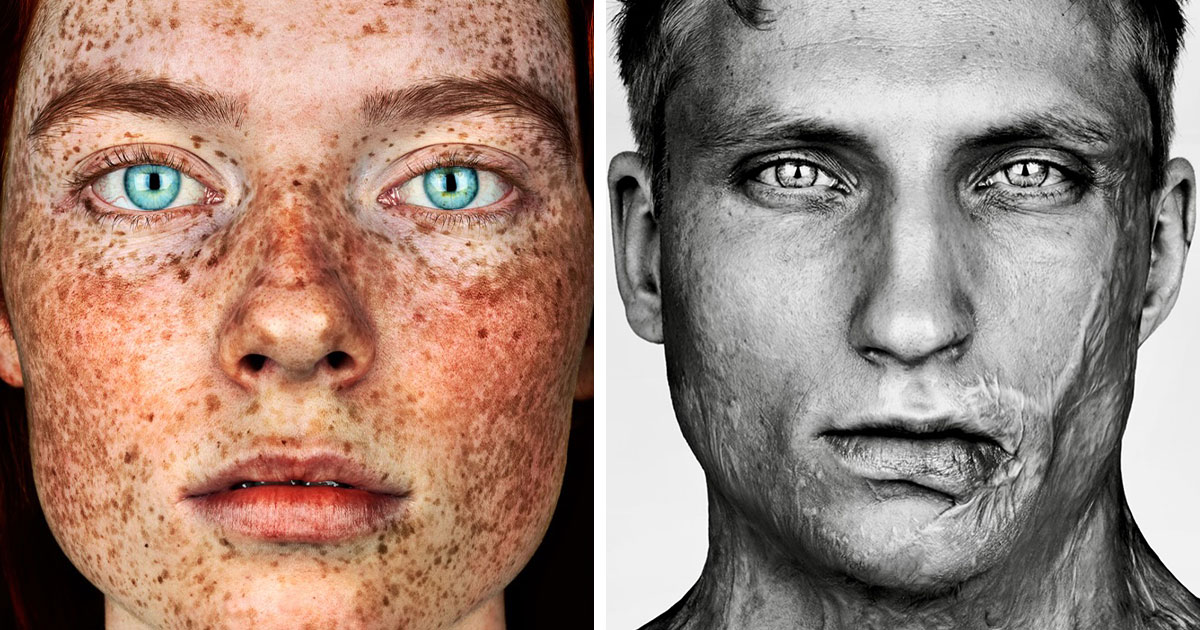 28 Powerful Portraits Exploring Unique Features, Identity, And Human Stories
