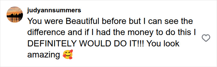 51-Year-Old Woman Goes Viral After She Breaks Down The Biggest Surprises Of Her Facelift 51-Year-Old Woman Goes Viral After She Breaks Down The Biggest Surprises Of Her Facelift