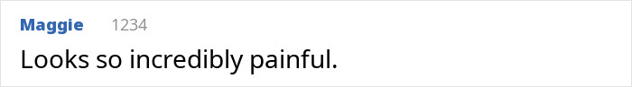 A comment about a woman with a rare skin condition, stating, Looks so incredibly painful. A comment about a woman with a rare skin condition, stating, Looks so incredibly painful.