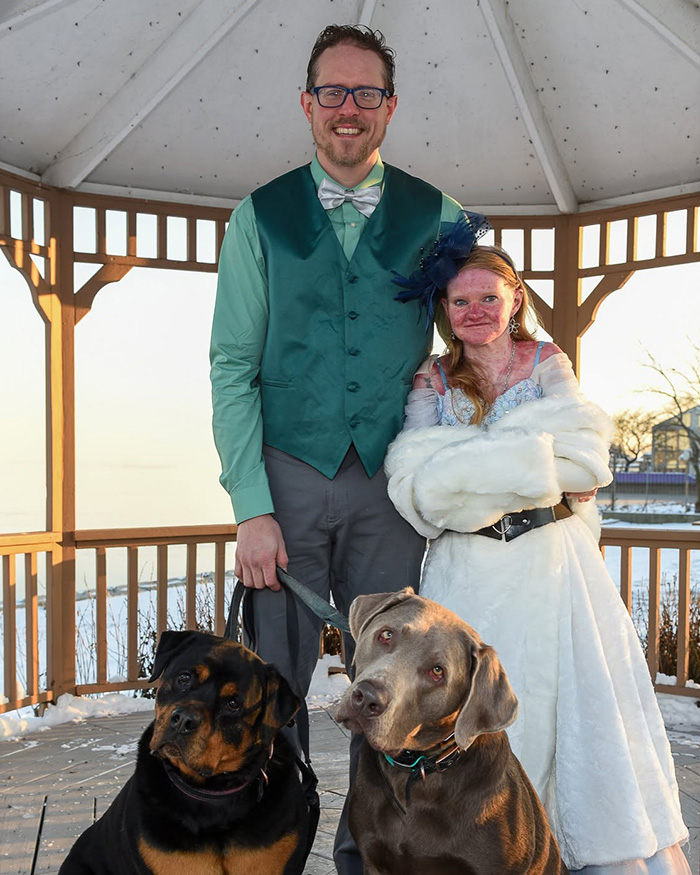 Woman with skin condition and man with two dogs in gazebo. Details extreme measures for rarest skin conditions. Woman with skin condition and man with two dogs in gazebo. Details extreme measures for rarest skin conditions.