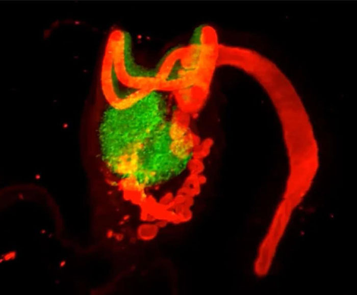 Microscopic image of a female body part showing fluorescent red and green structures Microscopic image of a female body part showing fluorescent red and green structures