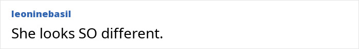 Screenshot of a comment: She looks SO different. More scrutiny on Jennifer Lawrence plastic surgery.