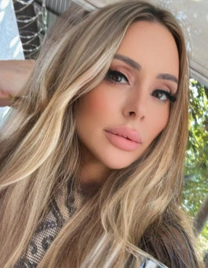 Close-up of a woman after cosmetic procedures, highlighting the potential risks of multiple surgeries. Close-up of a woman after cosmetic procedures, highlighting the potential risks of multiple surgeries.