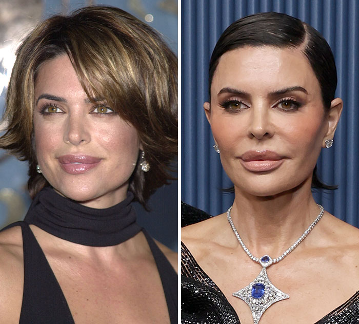 Lisa Rinna's incredible plastic surgery and weight loss transformation at the Emmys.