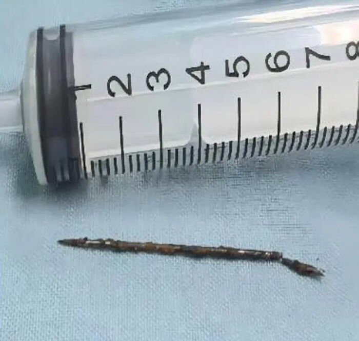 Rusty metal foreign body removed from patient next to syringe for scale