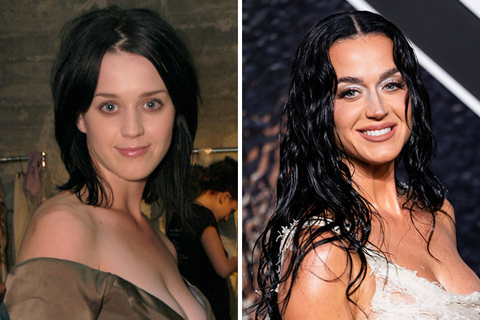 Katy Perry's looksmaxxing transformation through the years, highlighting potential cosmetic procedures.