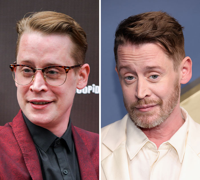 Macaulay Culkin's plastic surgery and weight loss transformation, showing a changed appearance for the 2026 Emmys.