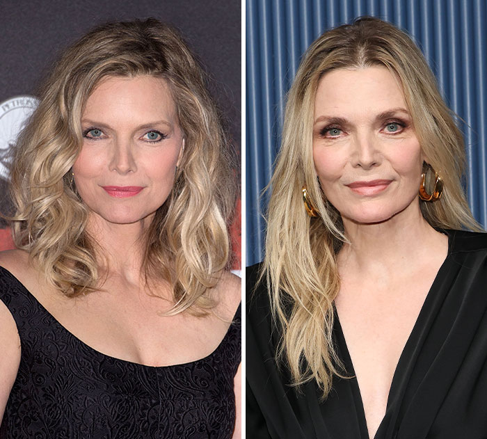 Michelle Pfeiffer's plastic surgery and weight loss transformation ahead of the 2026 Emmys.